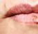 ¿Por qué se agrietan los labios y aparecen atascos?